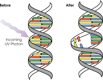 DNA damage caused by UV radiation.